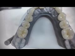 Prothèses en zirconium qui imitent les dents naturelles