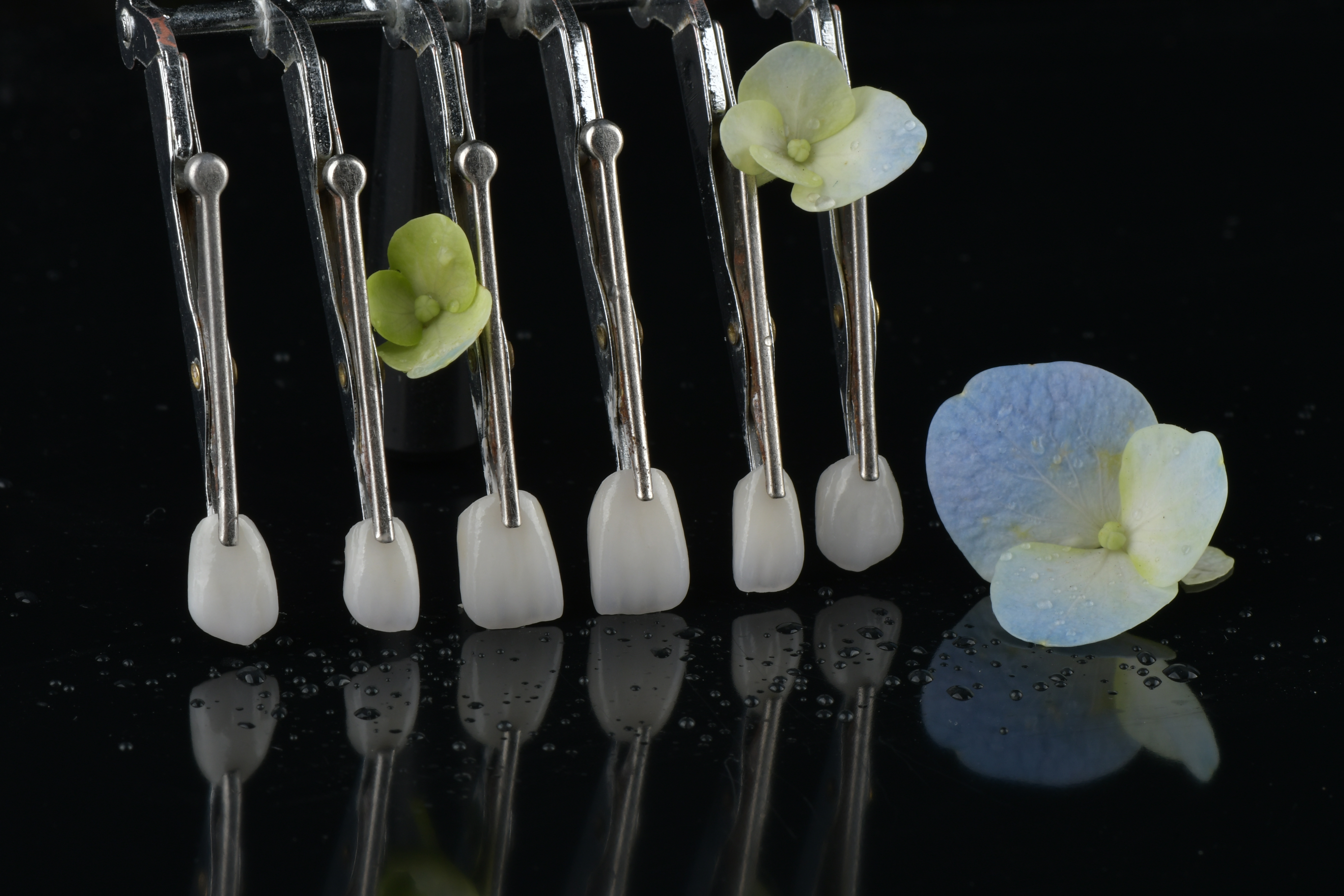 Derniers blogs de l'entreprise sur Les restaurations fixes nécessitent-elles des rendez-vous de suivi ?