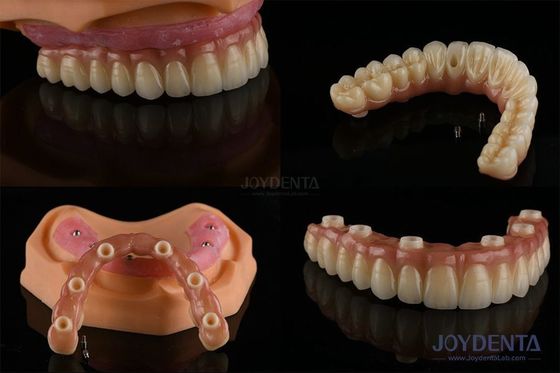 acheter Dentistique Remplacement de dents multiples Implants de surface rugueuse Composants prothétiques fabrication en ligne