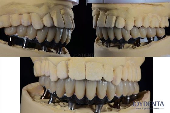 acheter Titane implant dentaire à dents multiples chirurgie prothétique connexion hexagonale externe fabrication en ligne
