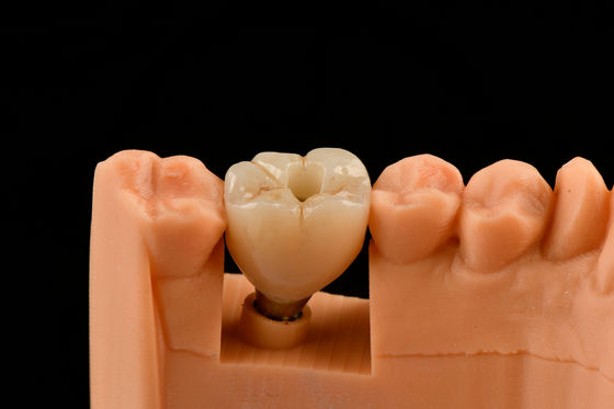 acheter Implants dentaires en titane de 10 mm sablé Implants dentaires auto-tapping fabrication en ligne