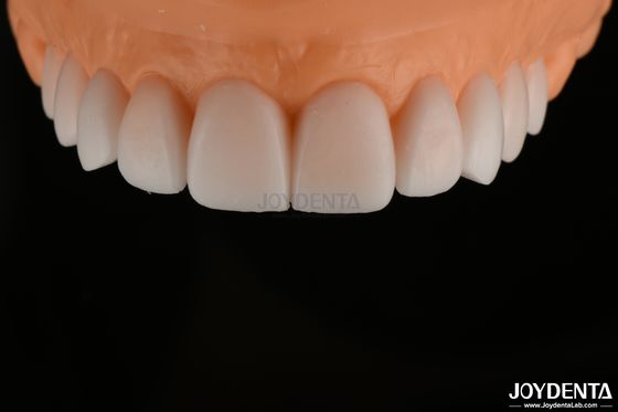 acheter Une détection de l' FDA, une détection des dents à pleine voûte, très précise. fabrication en ligne