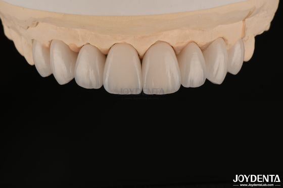 acheter Les facettes dentaires lisses et légères, biocompatibles et confortables pour la santé buccale fabrication en ligne