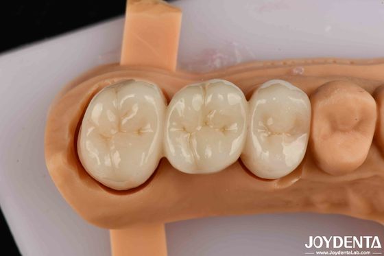 acheter Résistance à la flexion élevée Zirconia à contour complet Pour les couronnes Ponts Restauration dentaire fabrication en ligne