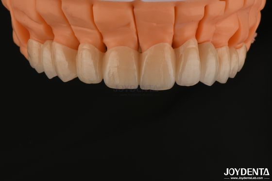 acheter Des ponts à couronne unique en zirconium à haute esthétique implantés pour les restaurations dentaires fabrication en ligne