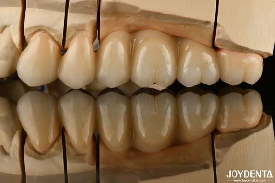 acheter Naturel à l' aspect multicouche Zirconie complète pour les restaurations dentaires Ultra translucide fabrication en ligne