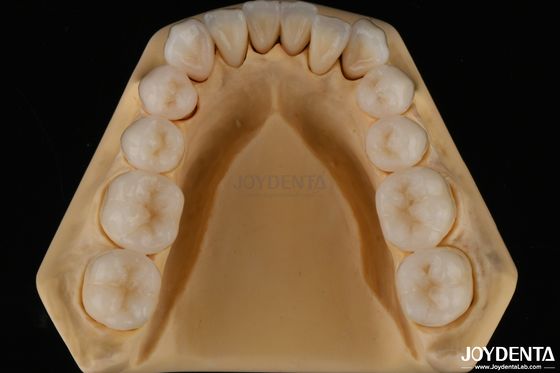 acheter Résistance à l'éclatement de la zirconie complète à la structure dentaire naturelle fabrication en ligne