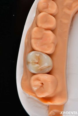 acheter Dentistique multi-couche couronnes et ponts en zirconium complet haute transparence apparence naturelle fabrication en ligne