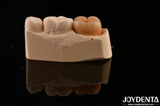 acheter Matériau de restauration dentaire multicouche Zirconie complète 1200 HV Dureté Résistance aux fissures fabrication en ligne