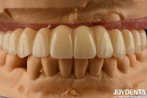 acheter Solution dentaire à base de Ti Zirconia Hybride Bridge Biocompatibilité élevée Apparence naturelle fabrication en ligne
