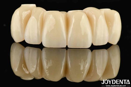 acheter Restauration dentaire à base de Ti Zirconia Pont hybride Naturel à l' air précis fabrication en ligne