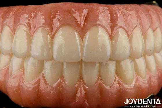 acheter Remplacement de pont hybride en zirconium pour les dents manquantes fabrication en ligne