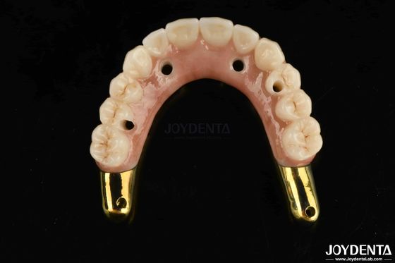 acheter Résistance à l'usure Pont hybride en zirconium avec barrière de Ti-Bar Compatible avec les dents et les gencives naturelles fabrication en ligne