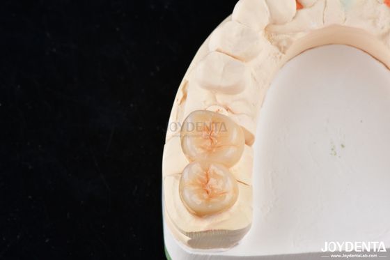 acheter Les incrustations et les incrustations dentaires en zirconium d'aspect naturel sont très esthétiques et précises fabrication en ligne