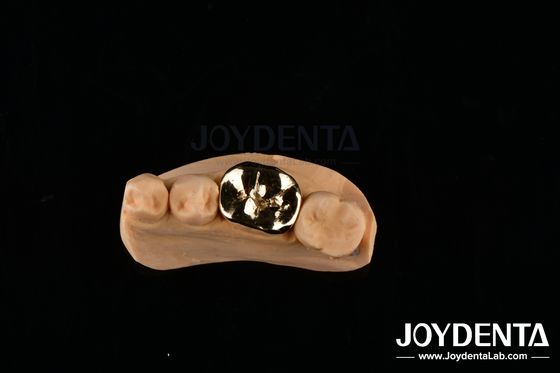 acheter FMC métallique réparation clinique orale matériaux d'implants dentaires résistants aux abrasifs fabrication en ligne