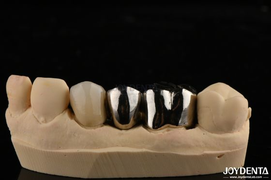 acheter Couronne en alliage métallique résistant à l'abrasion pour les restaurations dentaires sur mesure fabrication en ligne
