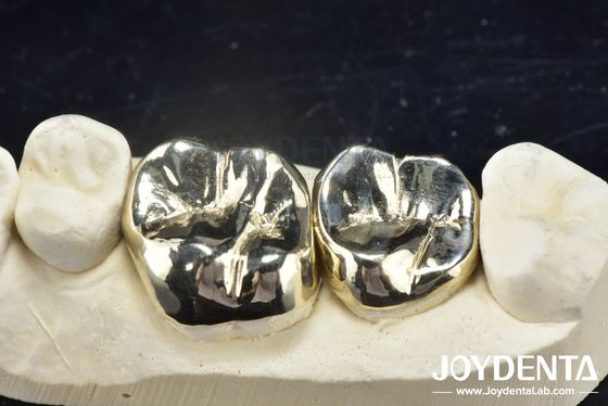 acheter Réparation dentaire par coulée de cire Couronne en métal complet Pour la réhabilitation buccale résistante à l'abrasion fabrication en ligne