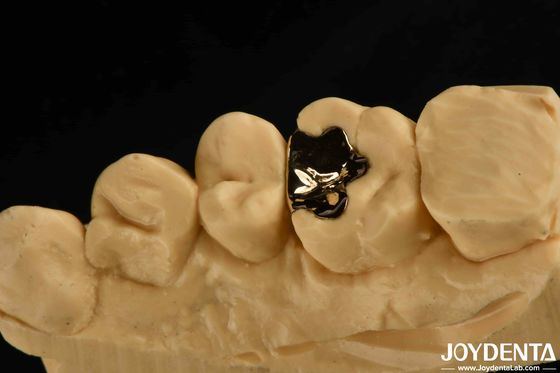 acheter Chauffure dentaire en or métallique clinique couronne 60K d'or pour la réhabilitation buccale fabrication en ligne