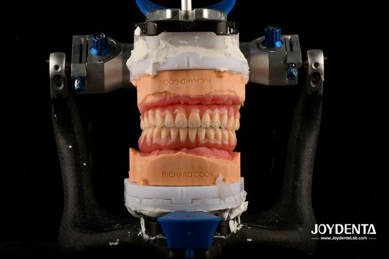 acheter Légère, confortable, adaptée, dentition dentaire acrylique, personnalisation professionnelle fabrication en ligne
