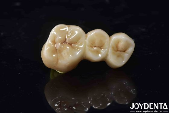 acheter Biocompatibilité élevée Couronne de contour complet en zirconie fabrication en ligne