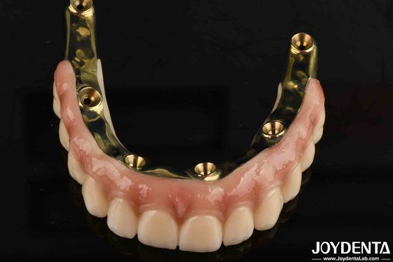 acheter Prothèses dentaires Pont hybride en zirconium en Ti-Bar avec des normes élevées de biocompatibilité fabrication en ligne