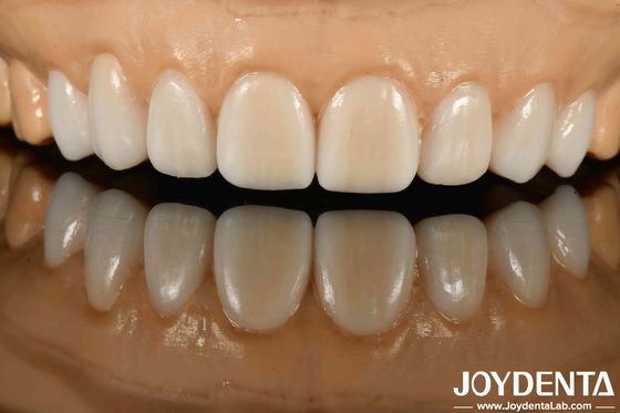 acheter Des matériaux variés de métaux et de résines de haute furtivité Finition de prothèse flexible pour la technologie furtive avancée fabrication en ligne