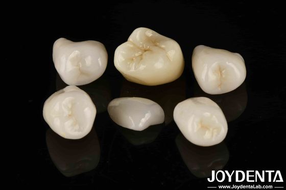 acheter Cimentation facile Emax Inlay Onlay Résistance moyenne Esthétique d'aspect naturel fabrication en ligne