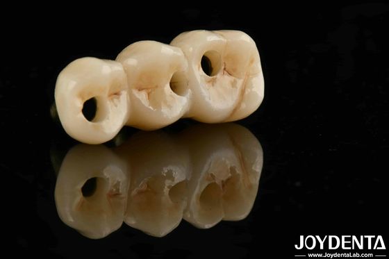 acheter Excellente biocompatibilité et résistance élevée couleur réaliste pleine zirconium pour les solutions d'approvisionnement B2B fabrication en ligne