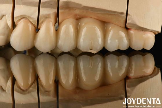 acheter Zirconium blanc avec une résistance élevée aux chocs thermiques fabrication en ligne