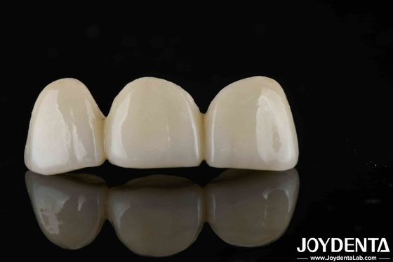 acheter Un style naturel avec des couches de zirconium, une haute translucide et une esthétique fabrication en ligne