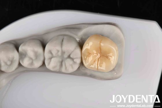 acheter Haute résistance aux chocs thermiques et à la corrosion, Zirconie complète avec une excellente stabilité chimique fabrication en ligne