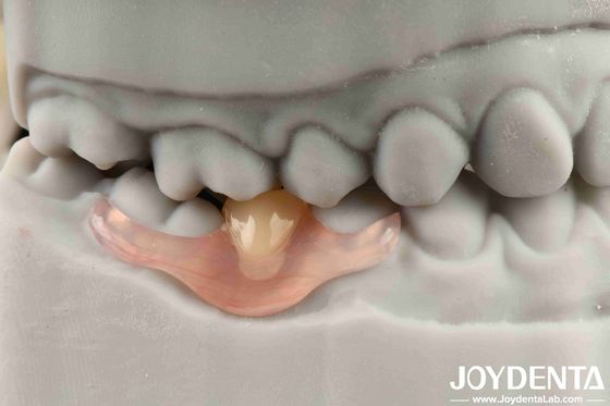 acheter Finition de dentition flexible personnalisée et technologie avancée d'aménagement dentaire pour les besoins personnalisés fabrication en ligne