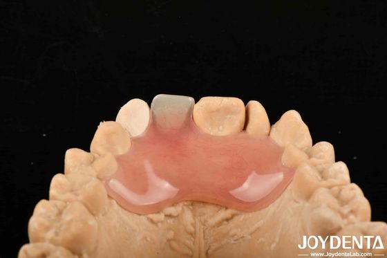 acheter Haute furtivité, bonne élasticité, finition de prothèse flexible pour divers procédés de fabrication fabrication en ligne