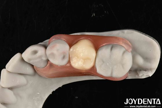 acheter Révolutionnez votre cadre de pratique dentaire, mettez en place des finitions dentaires avec une technologie élaborée de la dentisterie. fabrication en ligne