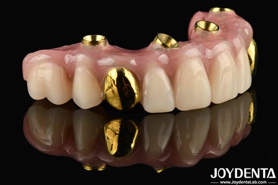 acheter 50 ml Dentwre des États-Unis Votre solution ultime Ti-Bar Acrylique Finition dentaire pour le traitement dentaire fabrication en ligne