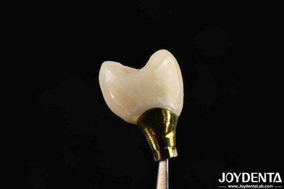 acheter Croix et pont d'implant de différentes tailles pour les implants dentaires solides Compatibilité fabrication en ligne