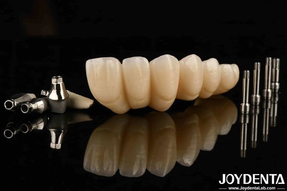 acheter Découvrez l'esthétique ultime avec une couronne et un pont d'implants dentaires esthétiques fabrication en ligne