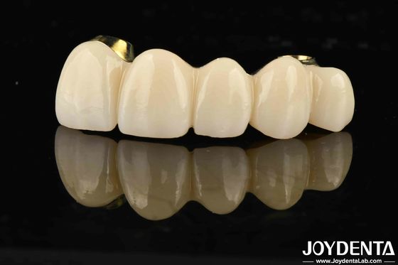 acheter Excellente résistance à l'usure, pont hybride en zirconium pour les dents et les gencives naturelles fabrication en ligne