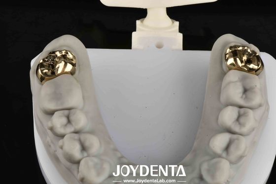 acheter Réhabilitation buccale avec un sourire plus lumineux et plus sain fabrication en ligne