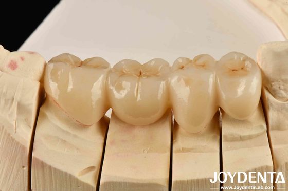 acheter Débloquez l'esthétique de l'esthétique haute Zirconia pleine avec blanc et résistance aux chocs thermiques haute fabrication en ligne