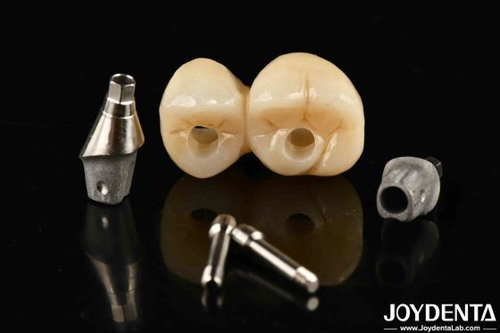 acheter Système de pont de couronne à support d'implants, résistant aux taches et à la décoloration fabrication en ligne