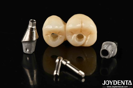 acheter Implantation dentaire en porcelaine personnalisable avec support de pont et de couronne pour une esthétique exceptionnelle fabrication en ligne