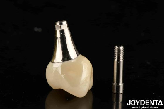 acheter Implants dentaires biocompatibles couronne et pont esthétiquement agréable pour la sécurité orale fabrication en ligne