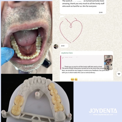 acheter Prothèses en zirconium qui imitent les dents naturelles fabrication en ligne