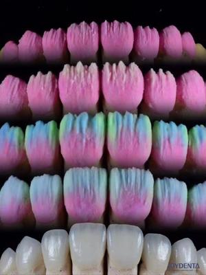 acheter The Joydenta Ceramic Veneer Process fabrication en ligne