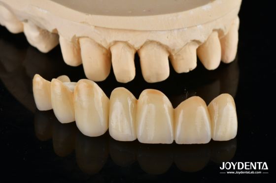 acheter Unveil True Biomimicry: Introducing Our Multi-Layered Zirconia Aesthetic Bridge fabrication en ligne