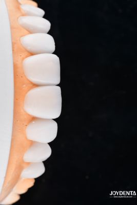 acheter Enhance Case Acceptance & Patient Communication with Our Diagnostic Wax-Up Service fabrication en ligne