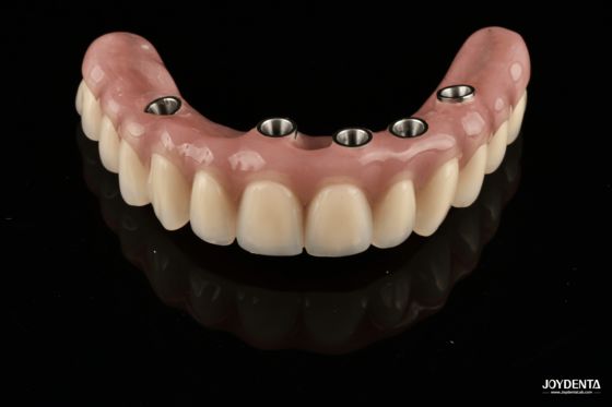 acheter Redefining Full Arch Prosthetics: Unmatched Fit and Function with Our Ti-Base Complete Dentures fabrication en ligne