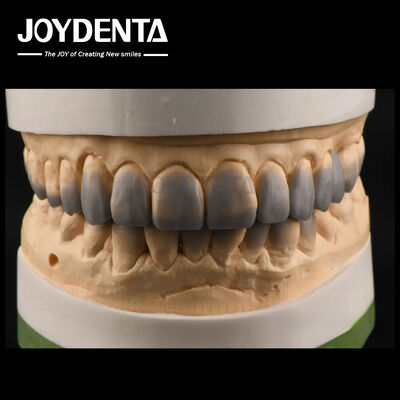 acheter Temporaire Utilisation de la cire de diagnostic Ups texture lisse Les dents de cire sur mesure fabrication en ligne