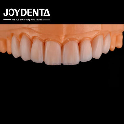 acheter Façade en verre céramique personnalisable, à l'aspect naturel, résistante aux produits chimiques fabrication en ligne